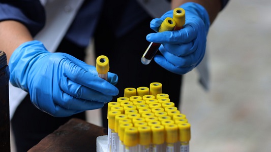 Новый штамм коронавируса «омикрон» захватывает мир